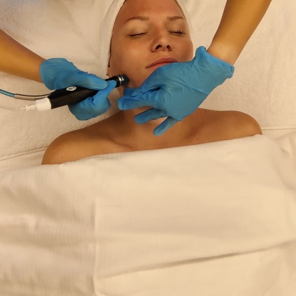Hydrafacial being performed